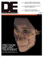 Vol 103 Issue 05 2014 05 Implant treatment Never take no from someone who can t say yes